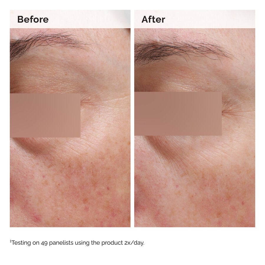 niacinamide-5-face-and-body-emulsion-h8 2024-08-23-ORD-Nia-5pct-Face-Body-B-A-Elasticity-Global-02-1x1.jpg