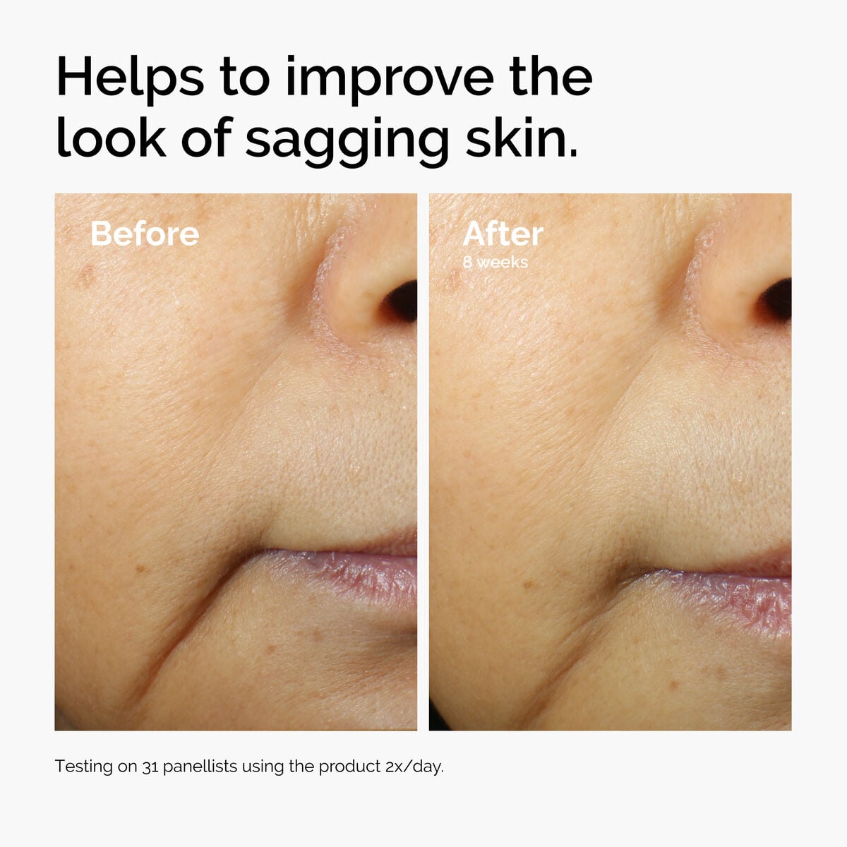 caffeine-3-escin-1-face-serum-n5 ord-caffeine-3pct-escin-1pct-face-serum-before-after-sagging.jpg