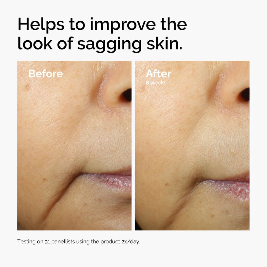 caffeine-3-escin-1-face-serum-n5 ord-caffeine-3pct-escin-1pct-face-serum-before-after-sagging.jpg