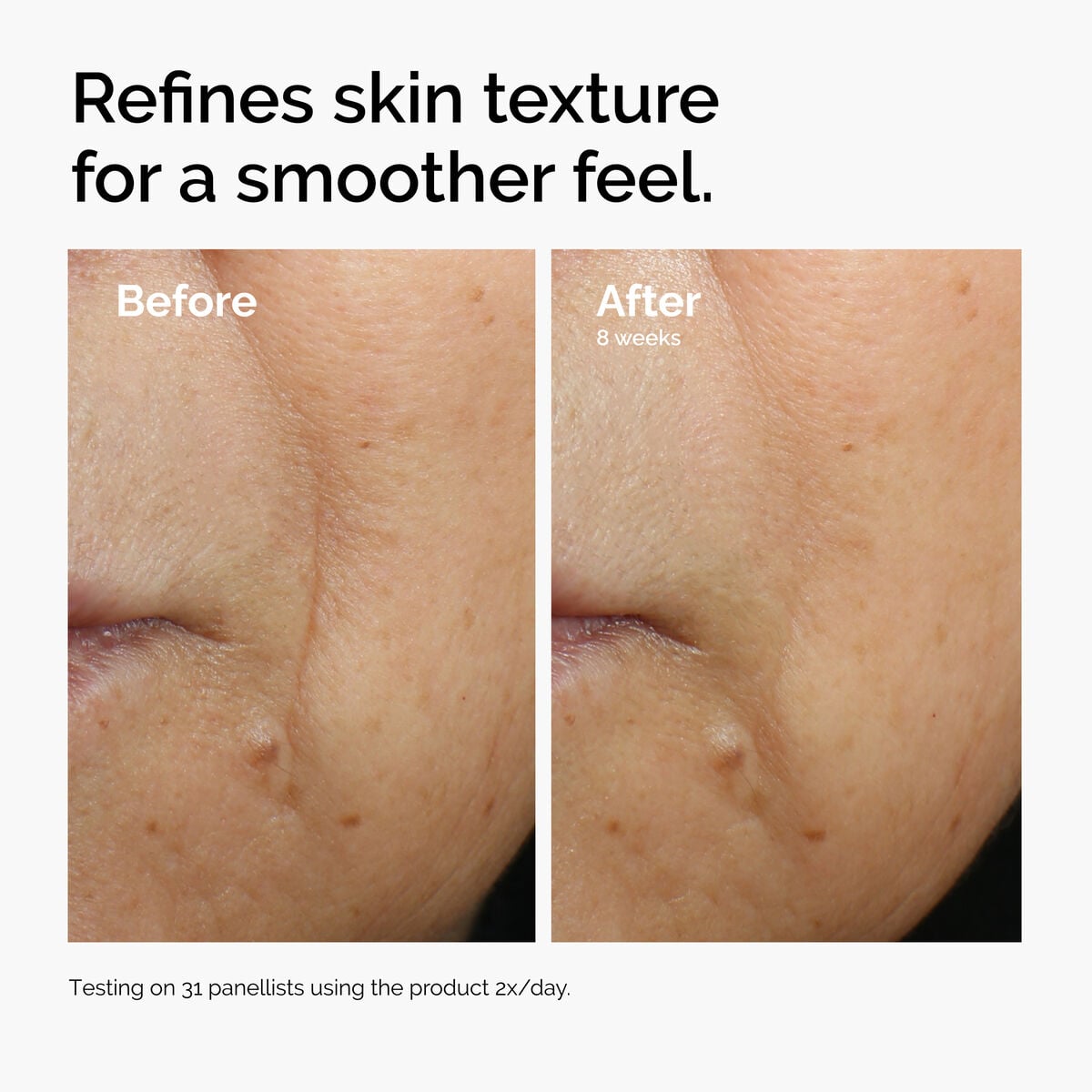 caffeine-3-escin-1-face-serum-n5 ord-caffeine-3pct-escin-1pct-face-serum-before-after-texture.jpg