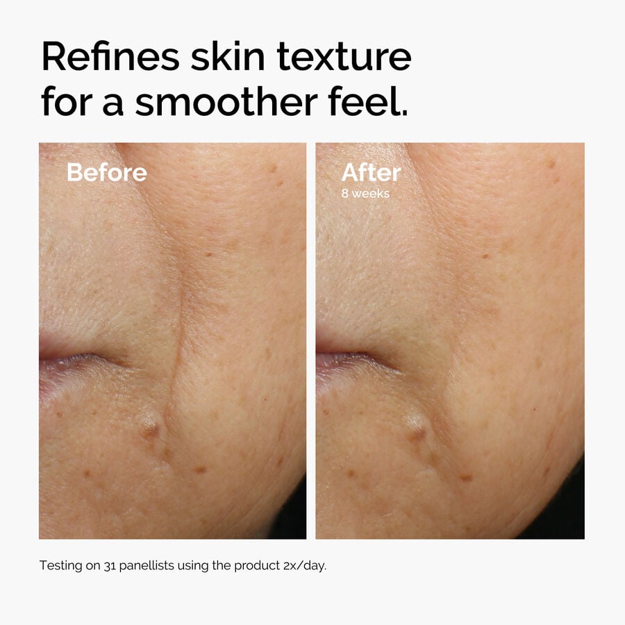 caffeine-3-escin-1-face-serum-m8 ord-caffeine-3pct-escin-1pct-face-serum-before-after-texture.jpg