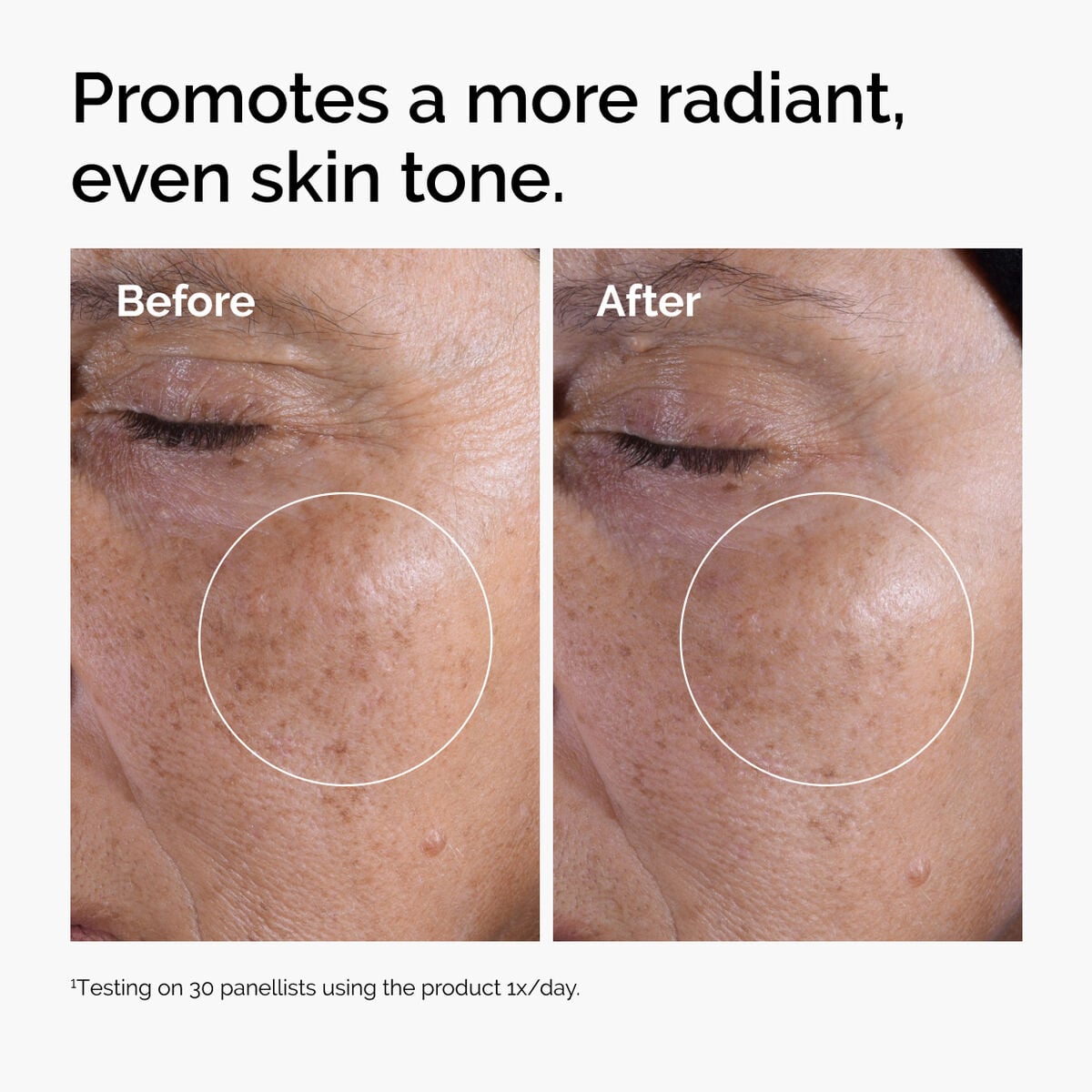 glycolic-acid-7-exfoliating-toner-j0 ord-glycolic-before-after-radiance.jpg