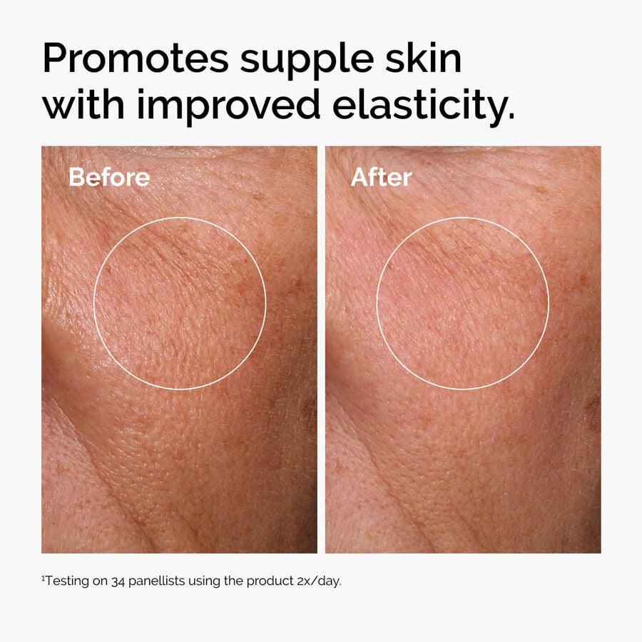 hyaluronic-acid-2-b5-with-ceramides-e0 ord-hyaluronic-acid-2pct-b5-hydrating-serum-before-after-elasticity.jpg