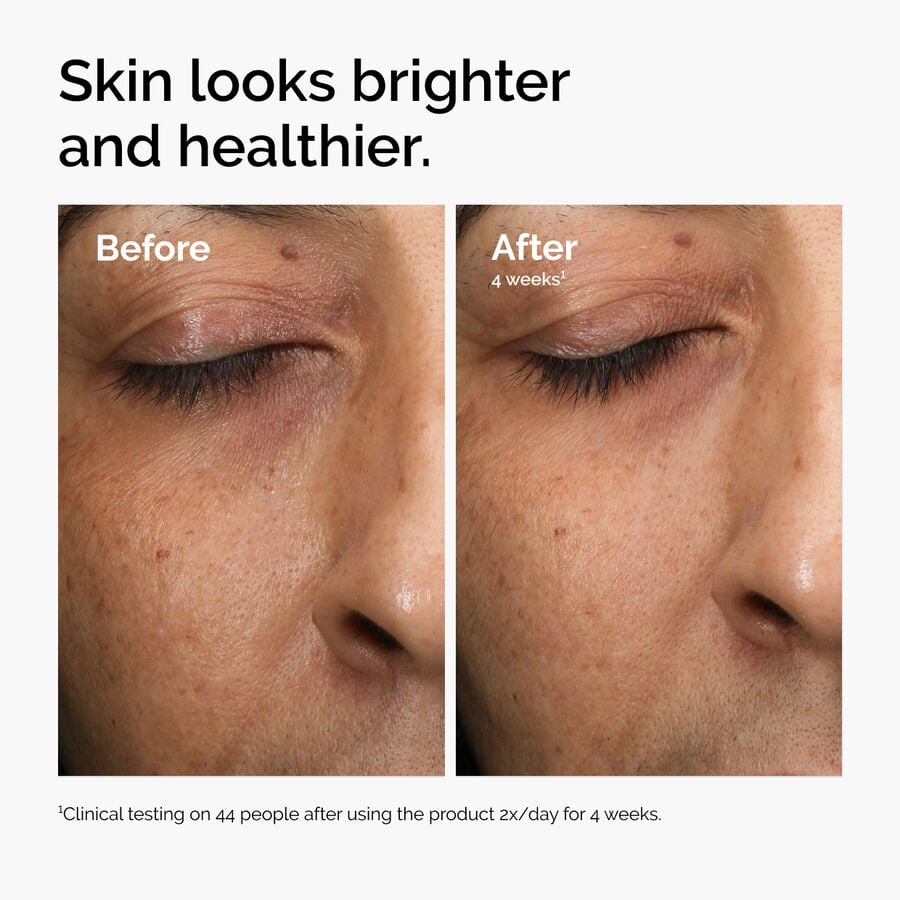 multi-antioxidant-radiance-serum-r8 ord-mars-before-after-healthy.jpg