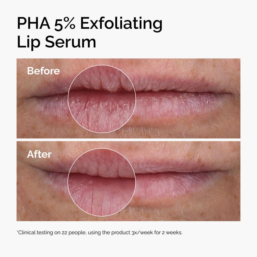 pha-5-exfoliating-lip-serum-y6 ord-pha-5pct-lip-exfoliating-serum-before-after.jpg